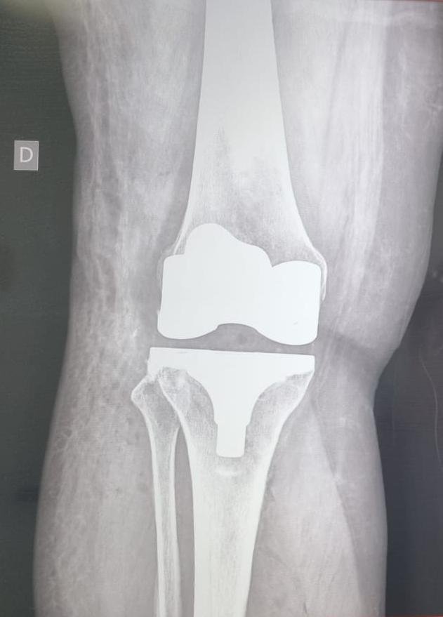 Dr. José Luis Rodríguez García especialista en Ortopedia y Traumatología en CDMX